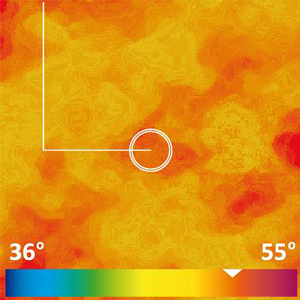 Imagem Termográfica Criofrequência